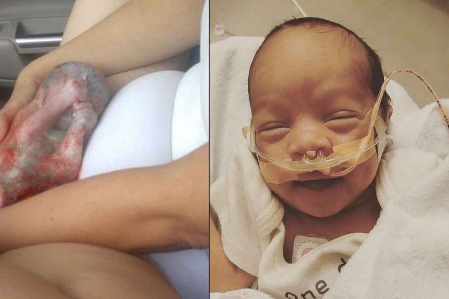 Tak sampai hospital tak tahan sakit bersalin, wanita ini terteran lahirkan bayi masih dalam karung ketuban