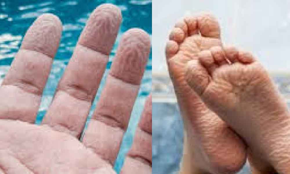 Rupanya ini sebab kenapa kulit jari berkedut lepas berendam lama dalam air